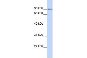 WB Suggested Anti-TRIM28 Antibody Titration: 0. (KAP1 Antikörper  (N-Term))