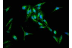 Immunofluorescence staining of Hela cells with ABIN7167114 at 1:133, counter-stained with DAPI. (RIN1 Antikörper  (AA 192-341))