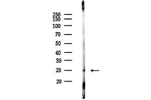 anti-Ephrin A5 (EFNA5) (Internal Region) antibody