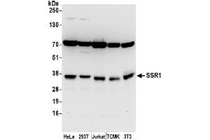 Western Blotting (WB) image for anti-Signal Sequence Receptor, alpha (SSR1) (AA 75-125) antibody (ABIN7452976)