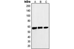 Western blot analysis of c-Myc (pS62) expression in A431 (A), HeLa (B), Jurkat (C) whole cell lysates.
