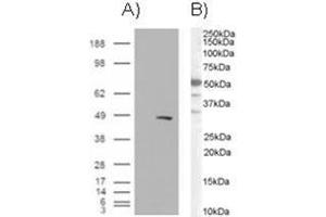 Image no. 1 for anti-SWI/SNF Related, Matrix Associated, Actin Dependent Regulator of Chromatin, Subfamily E, Member 1 (SMARCE1) (C-Term) antibody (ABIN374349) (SMARCE1 Antikörper  (C-Term))