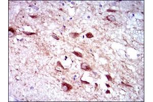 Immunohistochemistry (IHC) image for anti-Cytochrome P450, Family 3, Subfamily A, Polypeptide 4 (CYP3A4) antibody (ABIN969512)