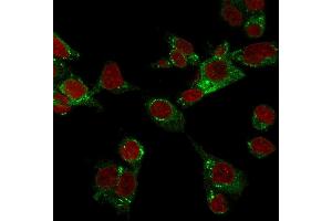 Confocal immunofluorescence image of HepG2 cells stained with GPX4 / MCSP Mouse Monoclonal Antibody (LHM 2) followed by Goat anti-Mouse CF488 (green).