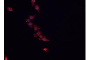 ABIN6266563 staining HeLa cells by IF/ICC.