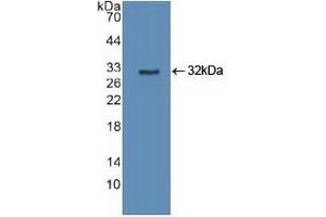 Western Blotting (WB) image for anti-Cytochrome P450, Family 27, Subfamily B, Polypeptide 1 (CYP27B1) (AA 256-508) antibody (ABIN7442201)