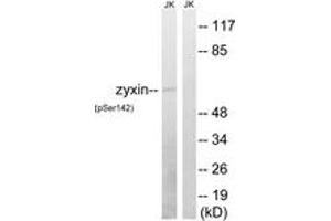 Western blot analysis of extracts from Jurkat cells treated with paclitaxel 1uM 24h, using Zyxin (Phospho-Ser142) Antibody.