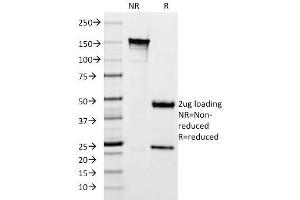 SDS-PAGE Analysis Purified Cytokeratin 10 Mouse Monoclonal Antibody (SPM261). (Keratin 10 Antikörper)