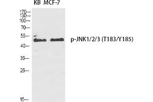 Western Blot analysis of KB (1), MCF-7 (2), diluted at 1:2000. (JNK Antikörper  (pThr183))