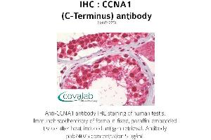 Image no. 1 for anti-Cyclin A1 (CCNA1) antibody (ABIN1732738) (Cyclin A1 Antikörper)