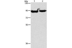 Western Blot analysis of Mouse heart and brain tissue using MARK1 Polyclonal Antibody at dilution of 1:500 (MARK1 Antikörper)