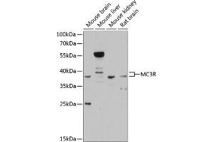 Western blot analysis of extracts of various cell lines, using MC3R antibody (ABIN6128220, ABIN6143613, ABIN6143616 and ABIN6215298) at 1:3000 dilution. (MC3R Antikörper  (AA 1-120))