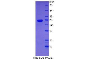 SDS-PAGE analysis of Human SHBG Protein.