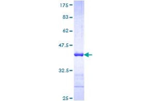 NEFH Protein (AA 263-363) (GST tag)