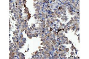 IHC analysis of MSF/SEPTIN9 using anti-MSF/SEPTIN9 antibody (ABIN7600104). (Septin 9 Antikörper  (AA 15-282))