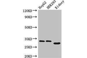 Western Blot Positive WB detected in: HepG2 whole cell lysate, HEK293 whole cell lysate, Mouse kidney tissue All lanes: GEMIN8 antibody at 4 μg/mL Secondary Goat polyclonal to rabbit IgG at 1/50000 dilution Predicted band size: 29 kDa Observed band size: 29, 33 kDa