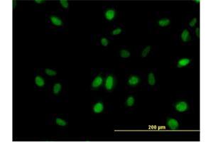 Immunofluorescence of monoclonal antibody to SURB7 on HeLa cell. (MED21 Antikörper  (AA 1-144))