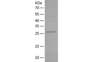 Zinc Finger Protein 439 (ZNF439) (AA 14-295) protein (His-IF2DI Tag)