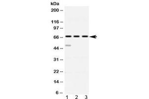 Western blot testing of 1) rat spleen, 2) mouse thymus and 3 human HeLa lysate with ABCE1 antibody at 0.