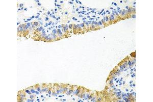 Immunohistochemistry of paraffin-embedded Mouse lung using TOB2 Polyclonal Antibody at dilution of 1:100 (40x lens). (TOB2 Antikörper)