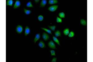 Immunofluorescence staining of A549 cells with ABIN7143677 at 1:120,counter-stained with DAPI. (ALDH3A1 Antikörper  (AA 210-453))