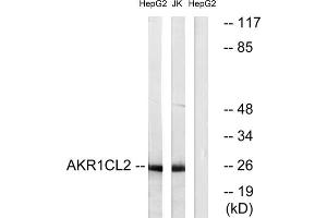 Western blot analysis of extracts from HepG2 cells and Jurkat cells, using AKR1CL2 antibody. (AKR1E2 Antikörper  (Internal Region))