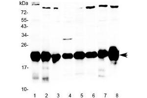 Western blot testing of rat 1) pancreas, 2) kidney, 3) skeletal muscle, 4) liver, 5) testis, 6) heart, 7) mouse kidney and 8) mouse skeletal muscle lysate with Park7 antibody at 0. (PARK7/DJ1 Antikörper)