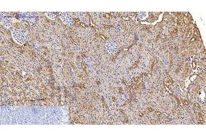 Immunohistochemistry of paraffin-embedded Rat kidney tissue using MAP1LC3A Monoclonal Antibody at dilution of 1:200. (MAP1LC3A Antikörper)
