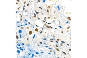 Immunohistochemistry of paraffin embedded rat placenta using Skar (ABIN7074970) at dilution of 1:1800 (400x lens) (p46 Antikörper)