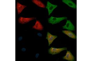 ABIN6261536 and ABIN6266485 staining  cells(H2O2 treatment) by IF/ICC. (ENOS Antikörper  (C-Term))