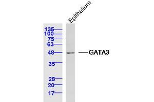 Mouse epithelium lysates probed with GATA3 Polyclonal Antibody, Unconjugated  at 1:300 dilution and 4˚C overnight incubation. (GATA3 Antikörper  (AA 151-250))