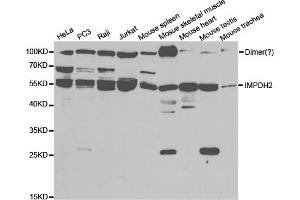Western blot analysis of extracts of various cell lines, using IMPDH2 antibody (ABIN5973086) at 1/1000 dilution. (IMPDH2 Antikörper)
