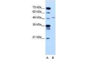 WB Suggested Anti-TYRP1 Antibody Titration:  2. (Tyrosinase-Related Protein 1 Antikörper  (N-Term))