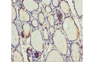 Immunohistochemistry of paraffin-embedded human thyroid tissue using ABIN7159798 at dilution of 1:100 (MTUS1 Antikörper  (AA 1041-1270))