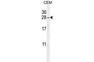 ARL5B Antikörper  (C-Term)