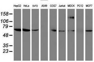 Image no. 3 for anti-Folate Hydrolase (Prostate-Specific Membrane Antigen) 1 (FOLH1) antibody (ABIN1500454) (PSMA Antikörper)