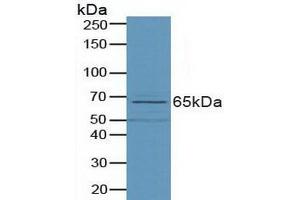 Detection of PLD in Porcine Small Intestine Tissue using Polyclonal Antibody to Phospholipase D (PLD) (Phospholipase D Antikörper  (AA 725-1074))