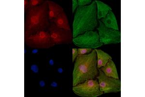 ABIN6259941 and ABIN6273031 staining  cells by IF/ICC. (Annexin VII Antikörper  (N-Term))
