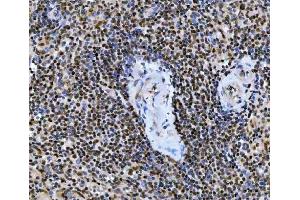 IHC analysis of Ubc13/UBE2N using anti-Ubc13/UBE2N antibody (ABIN7599924).