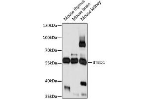 Western blot analysis of extracts of various cell lines, using BTBD1 antibody (ABIN6291275) at 1:1000 dilution. (BTBD1 Antikörper)