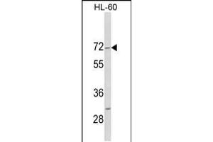 Western blot analysis of HIPK4 C-term in HL-60 cell line lysates (35ug/lane) (HIPK4 Antikörper  (C-Term))