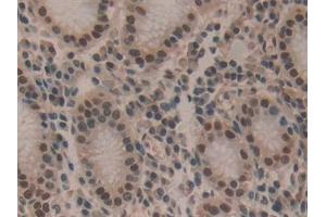 Immunohistochemistry (IHC) image for anti-Hepatoma-Derived Growth Factor (HDGF) (AA 10-240) antibody (ABIN7432232)