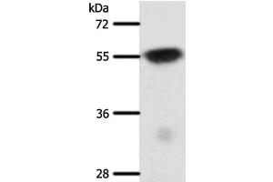 Western Blot analysis of Mouse brain tissue using SLC32A1 Polyclonal Antibody at dilution of 1:950 (SLC32A1 Antikörper)