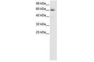 Image no. 3 for anti-Hematopoietic Cell-Specific Lyn Substrate 1 (HCLS1) (AA 28-77) antibody (ABIN6735791) (HCLS1 Antikörper  (AA 28-77))