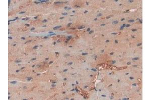 DAB staining on IHC-P; Samples: Human Heart Tissue