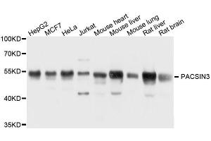 Western blot analysis of extracts of various cell lines, using PACSIN3 antibody. (PACSIN3 Antikörper  (AA 175-424))