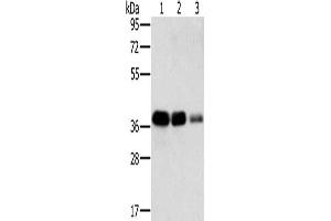 Gel: 8 % SDS-PAGE, Lysate: 40 μg, Lane 1-3: A549 cells, HT29 cells, A172 cells, Primary antibody: ABIN7130292(MTFR1 Antibody) at dilution 1/500, Secondary antibody: Goat anti rabbit IgG at 1/8000 dilution, Exposure time: 5 seconds (MTFR1 Antikörper)
