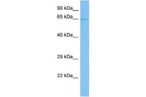 Western Blotting (WB) image for anti-Transforming Growth Factor, beta Receptor II (70/80kDa) (TGFBR2) (N-Term) antibody (ABIN2781999)