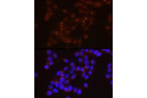 Immunofluorescence analysis of HeLa cells using LDL Receptor (LDLR) Rabbit mAb  at dilution of 1:150 (40x lens). (LDLR Antikörper)