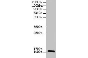 Western blot All lanes: RPLP1 antibody at 2 μg/mL Lane 1: EC109 whole cell lysate Lane 2: 293T whole cell lysate Secondary Goat polyclonal to rabbit IgG at 1/15000 dilution Predicted band size: 12, 9 kDa Observed band size: 12 kDa (RPLP1 Antikörper  (AA 2-114))